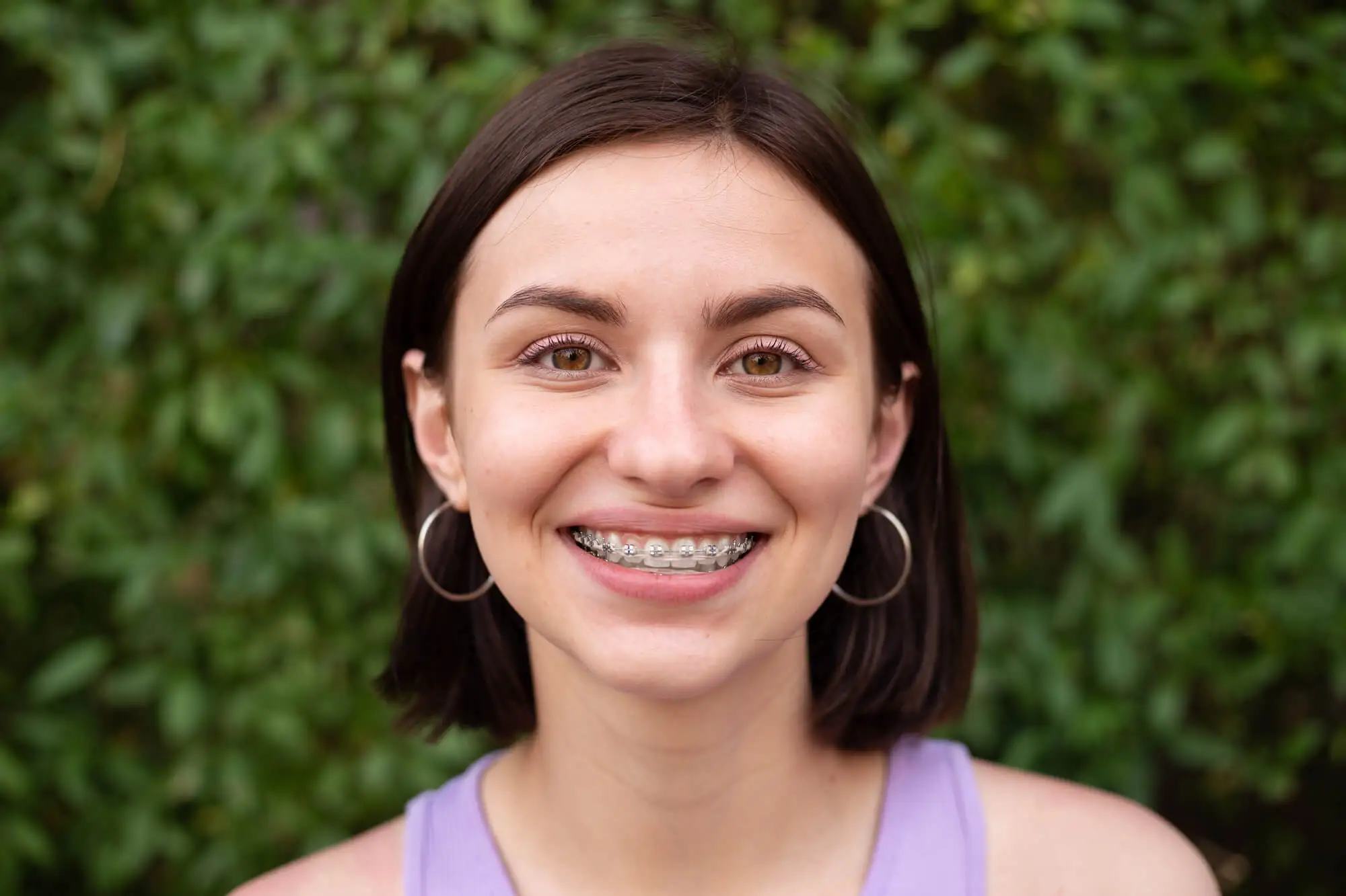 Orthodontist-in-Fleming-Island-FL-Explains-The-Parts-of-Braces