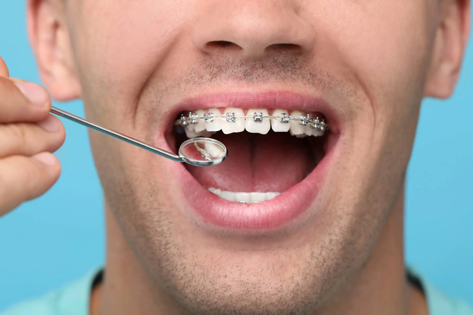 Orthodontist-in-Fleming-Island-FL